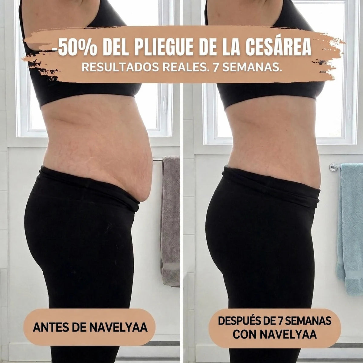 Antes y después de perfil de un abdomen posparto
